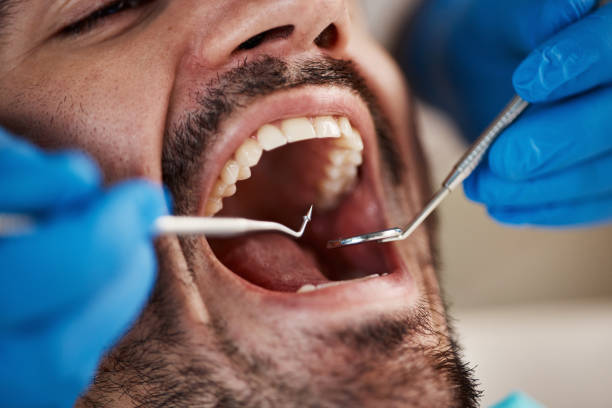 Best Dentist for Tooth Abscess  in Kelseyville, CA